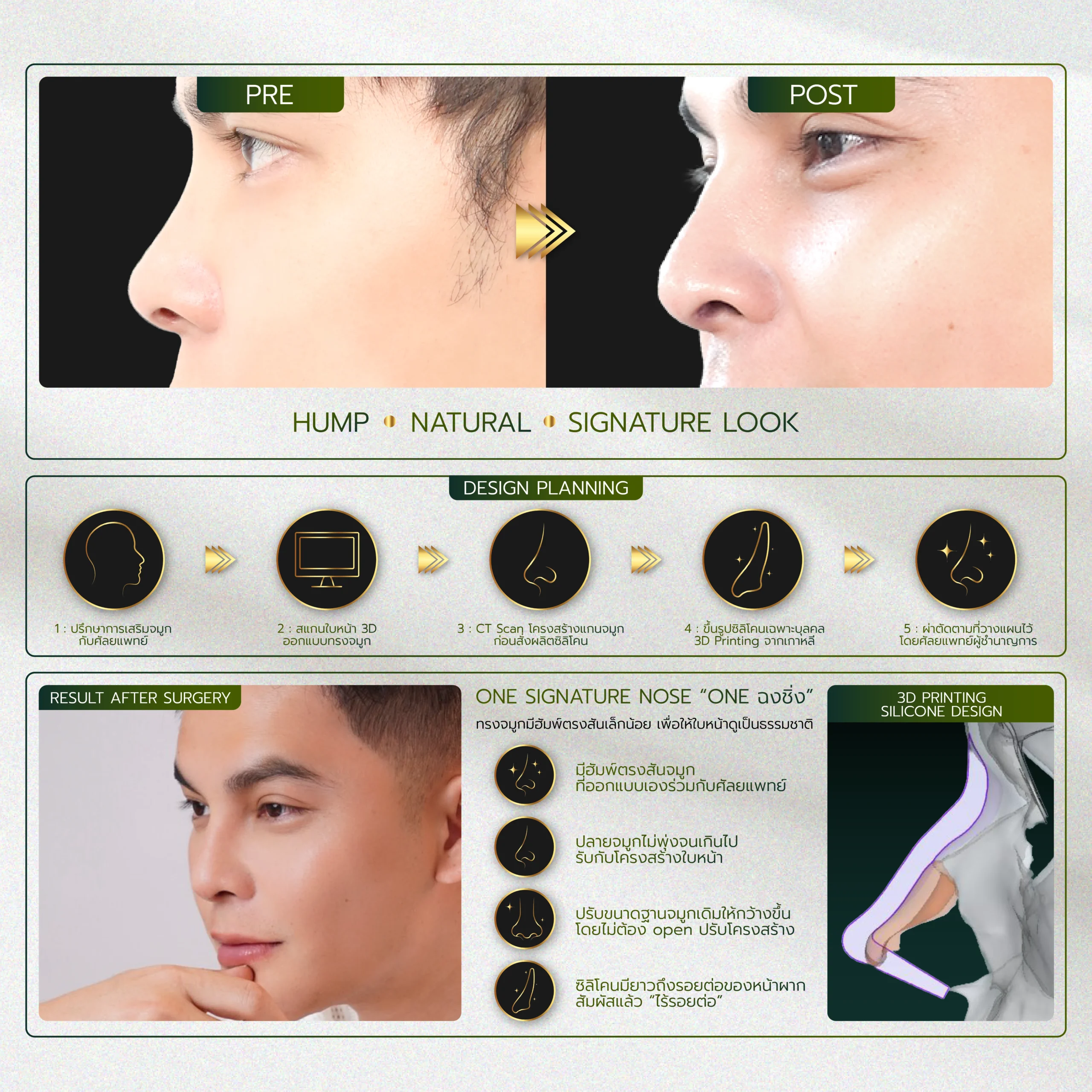 INFO รวมจมูก Website-02_31