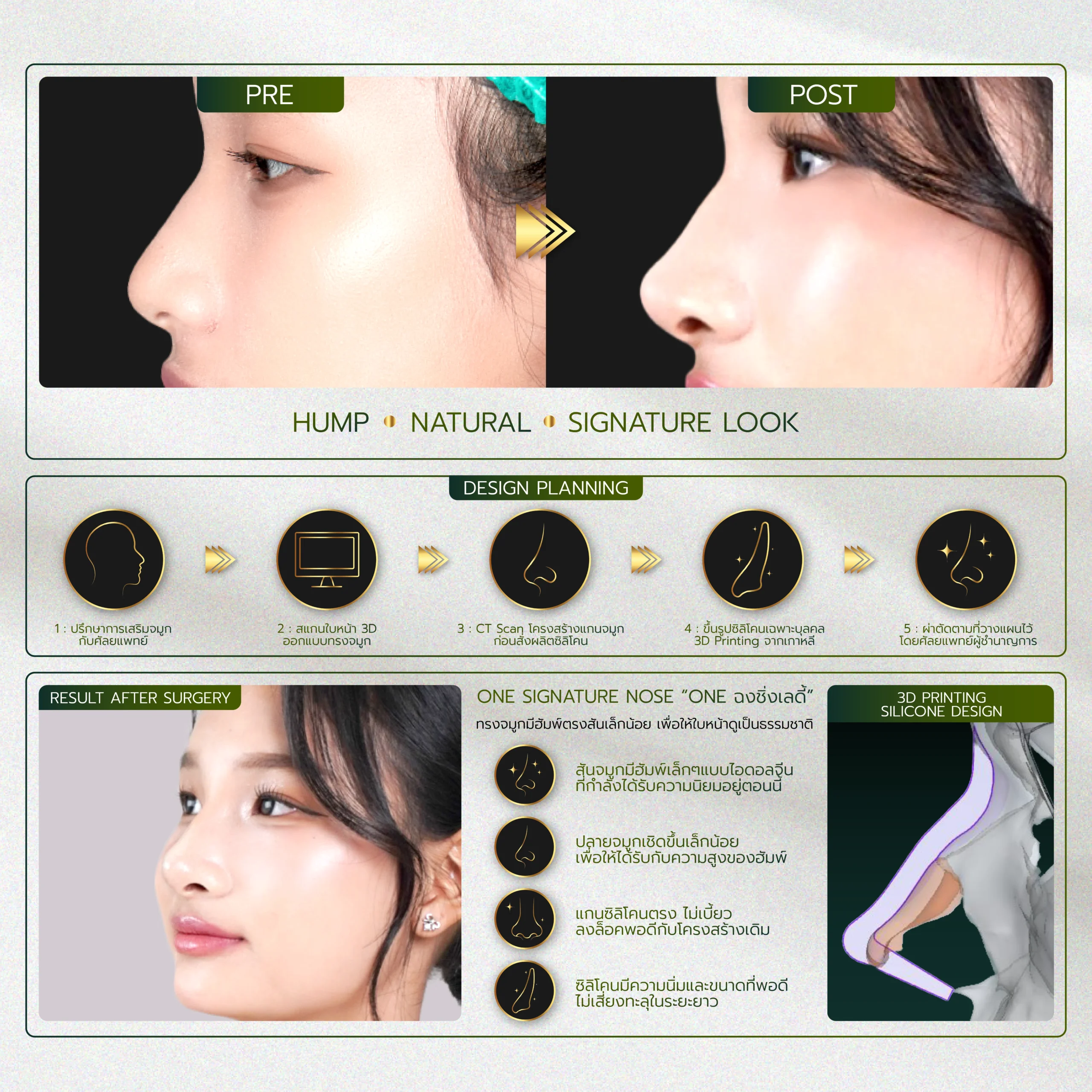 INFO รวมจมูก Website-03_30