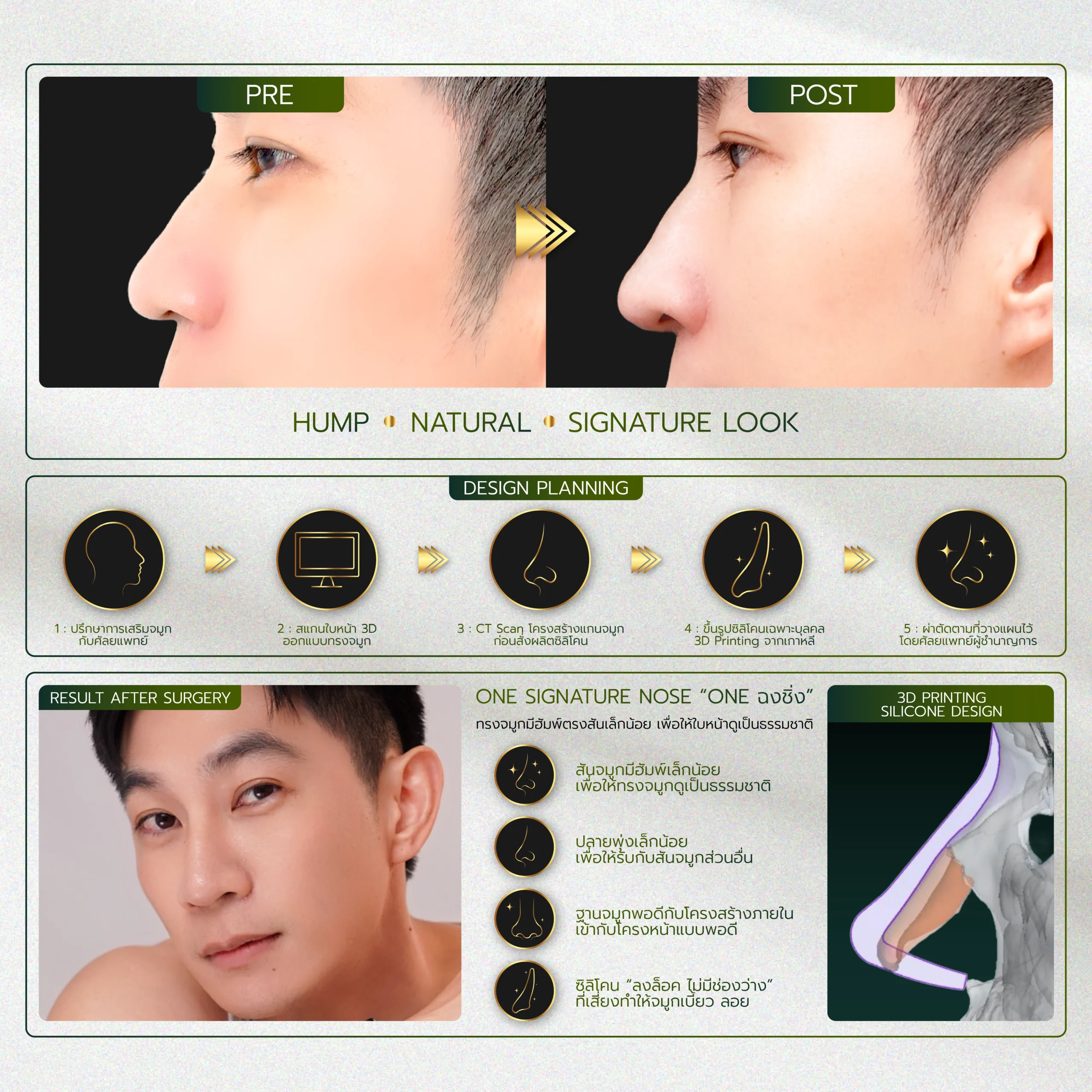 INFO รวมจมูก Website-04_29