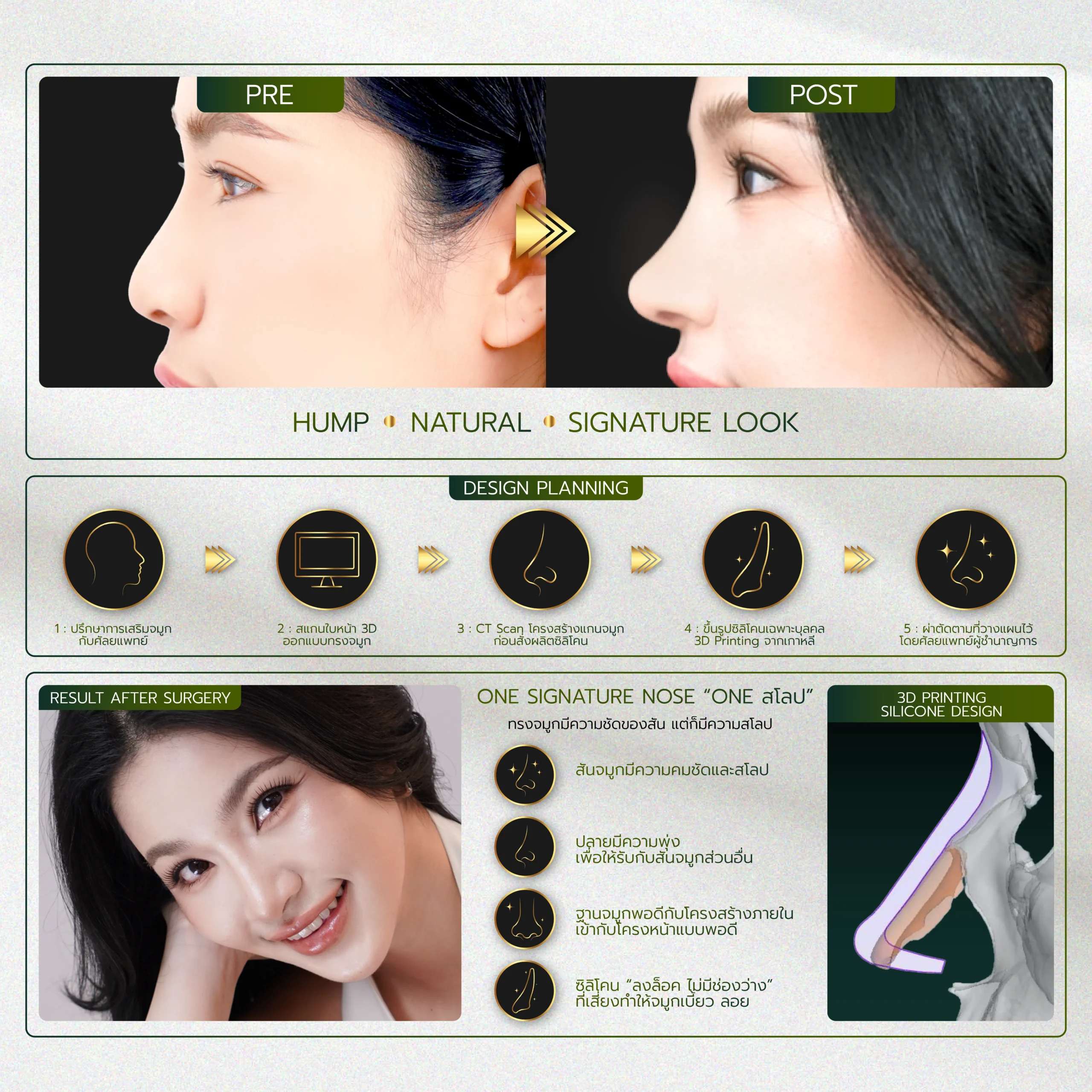 INFO รวมจมูก Website-05_28