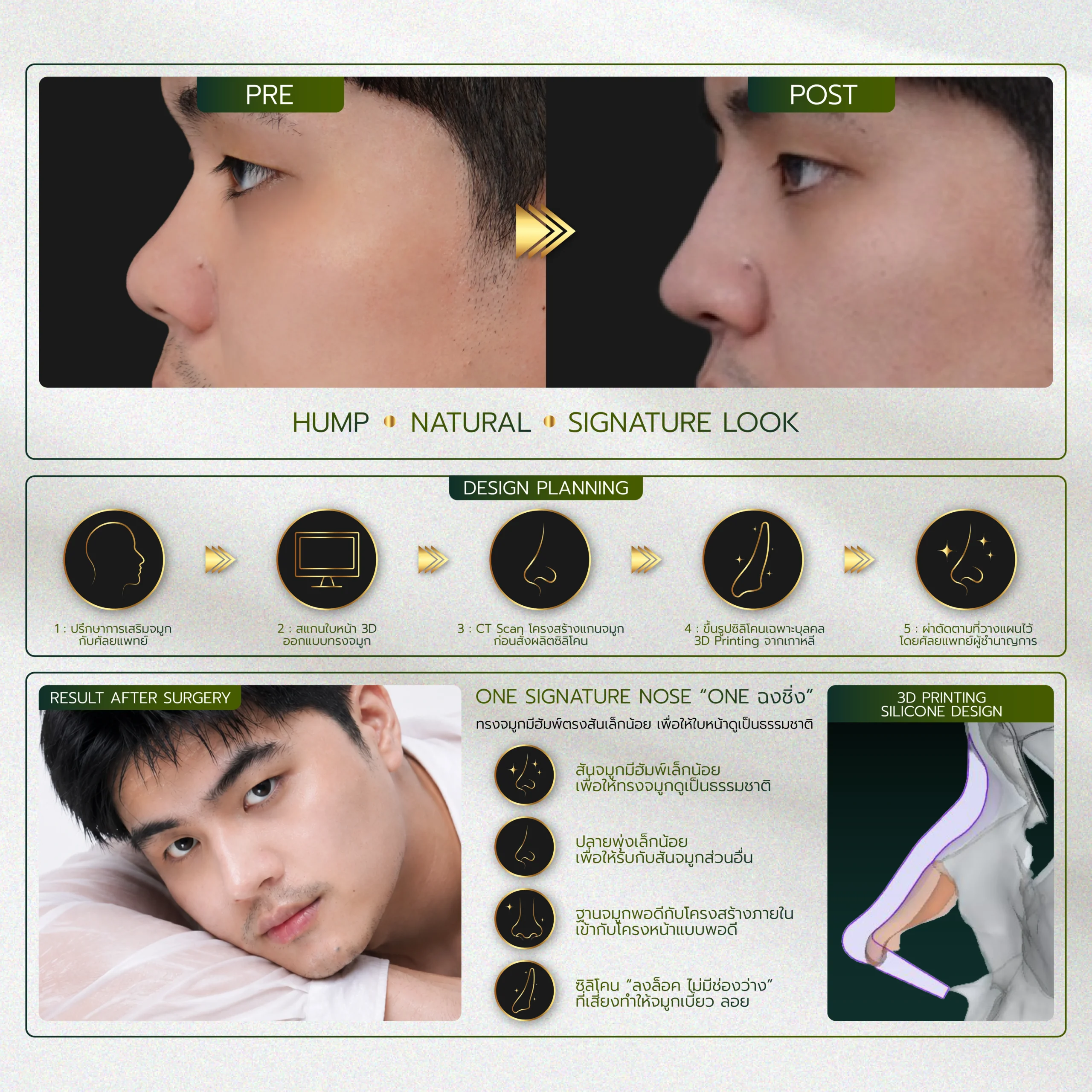 INFO รวมจมูก Website-06_27