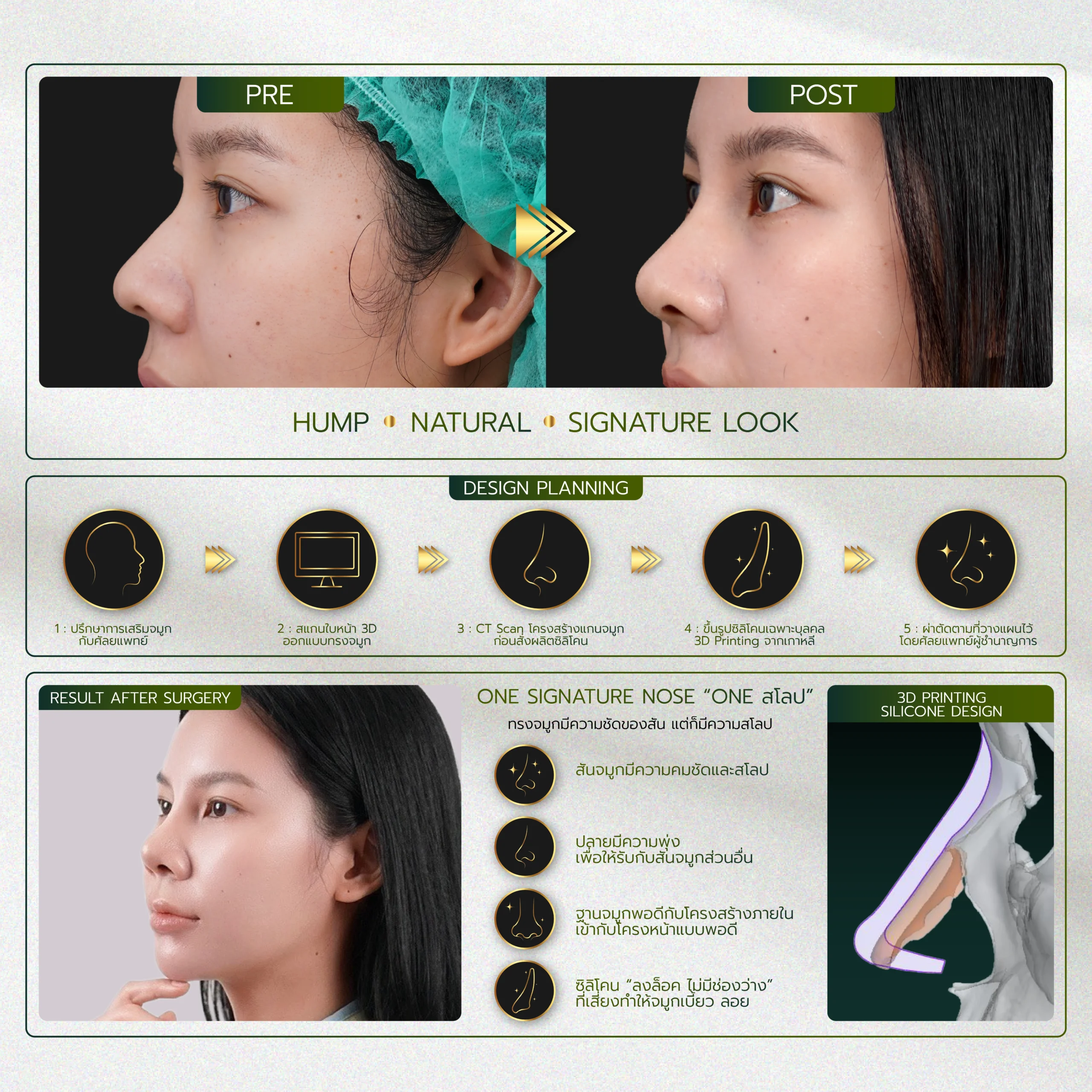 INFO รวมจมูก Website-07_26