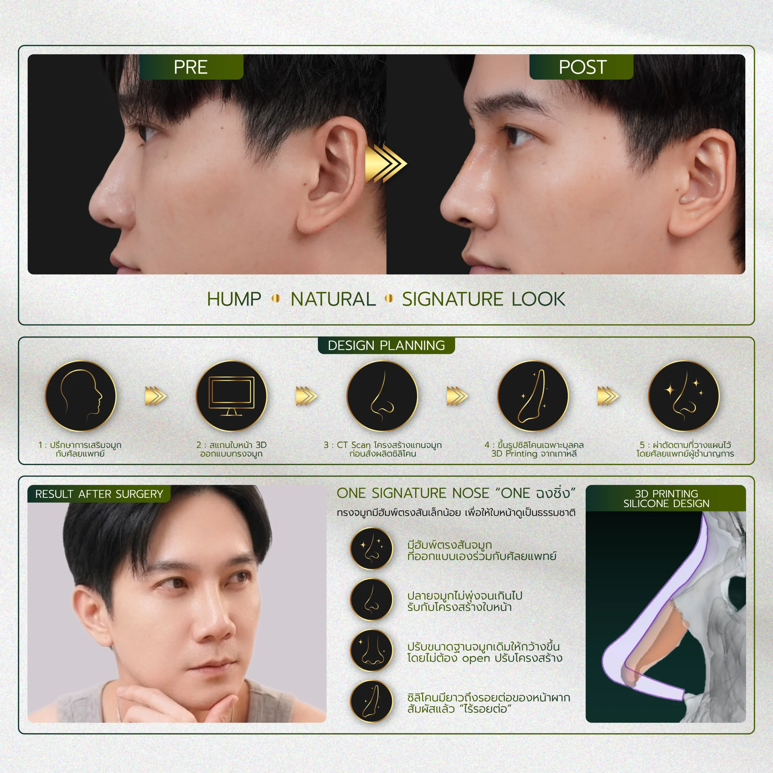 INFO รวมจมูก Website-08_25