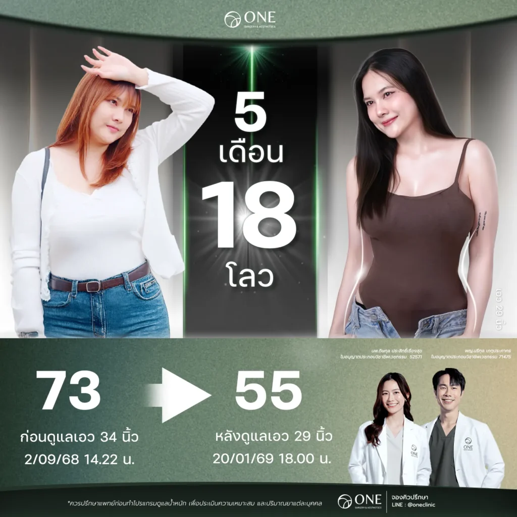 ปากกาลดน้ำหนัก