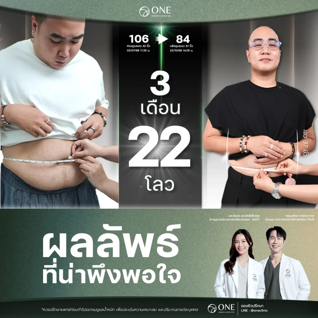 ปากกาลดน้ำหนัก