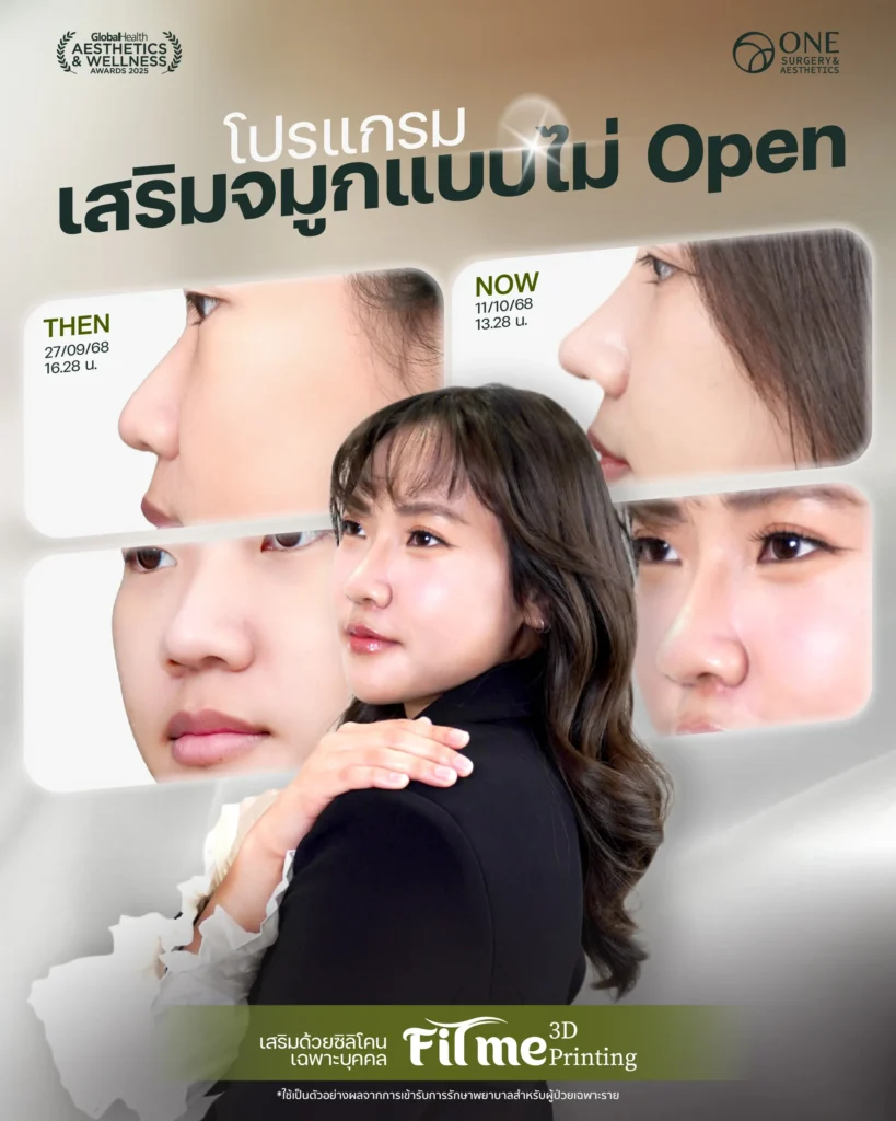 เสริมจมูก