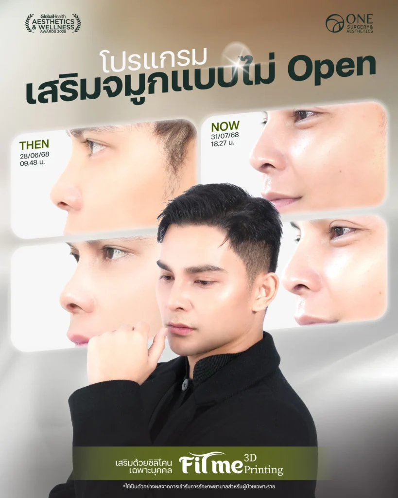 เสริมจมูก