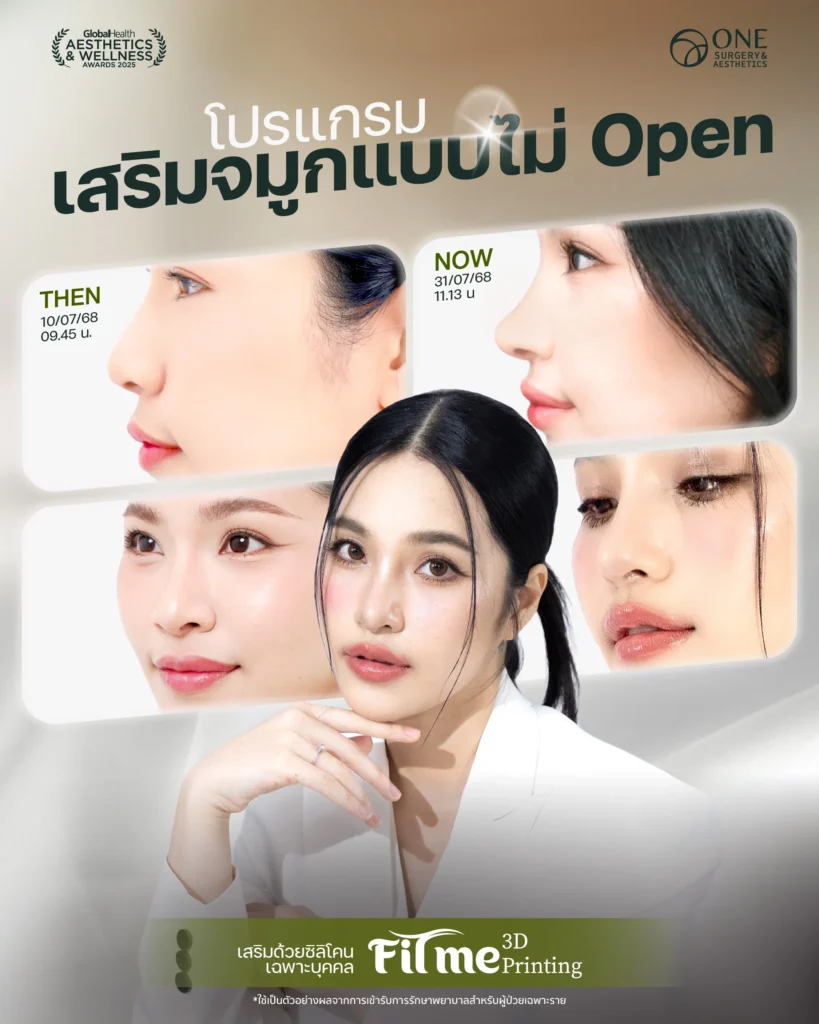เสริมจมูก