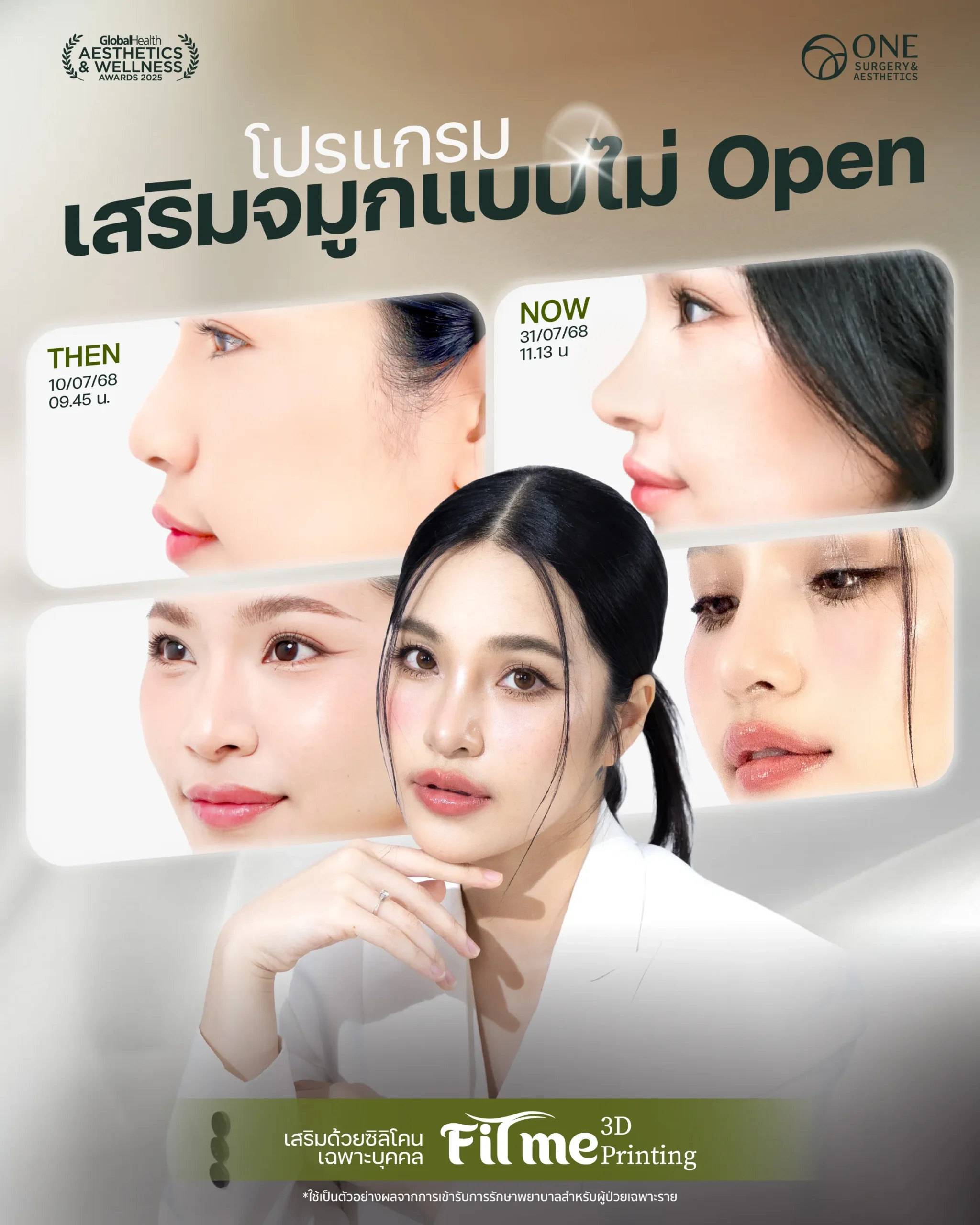 เสริมจมูก