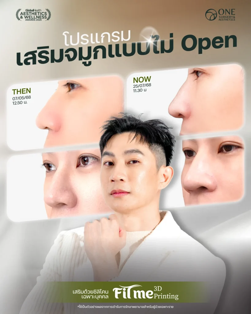 เสริมจมูก