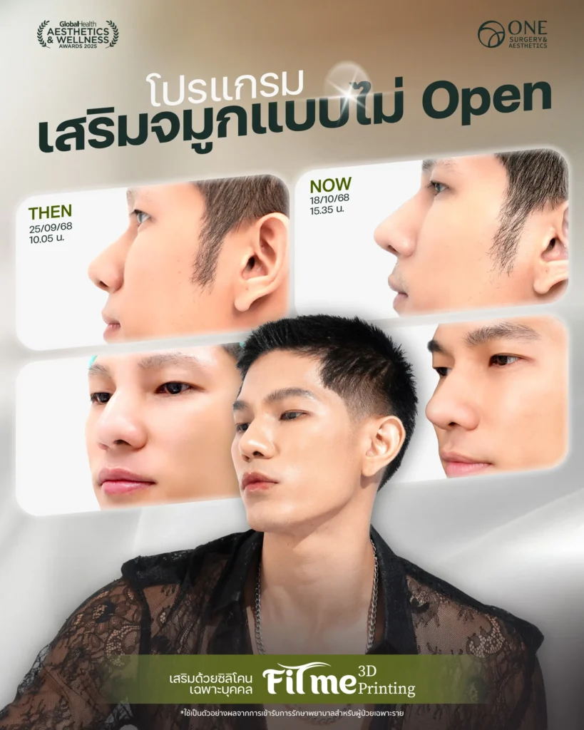 เสริมจมูก