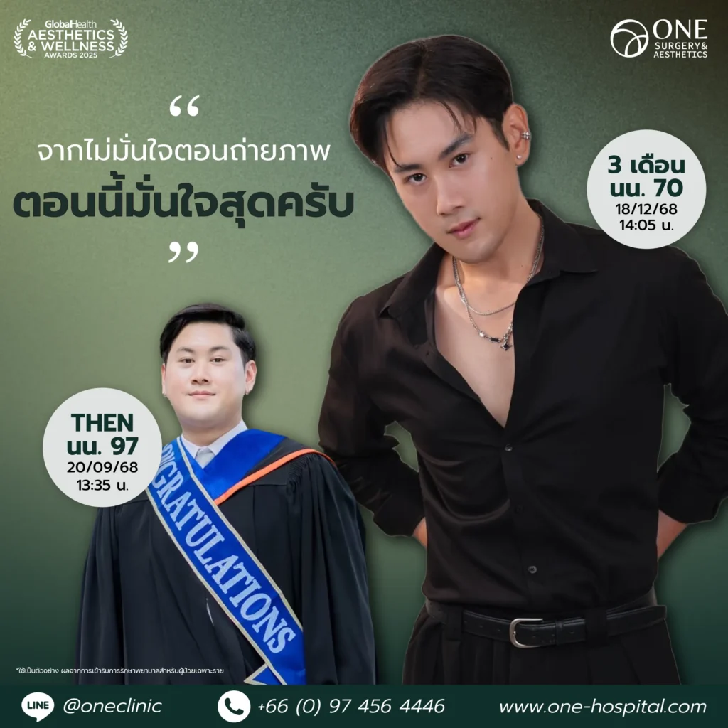 ปากกาลดน้ำหนัก