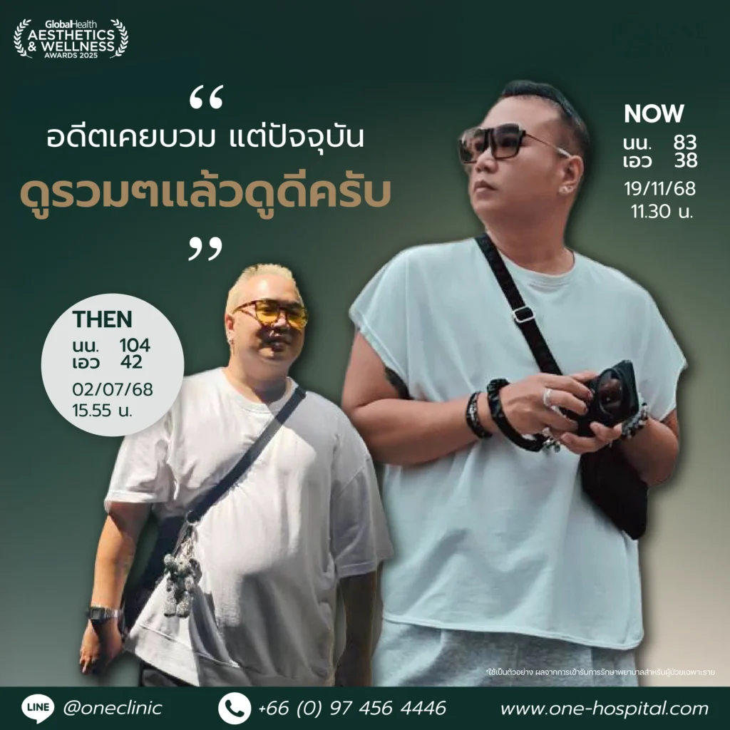 ปากกาลดน้ำหนัก