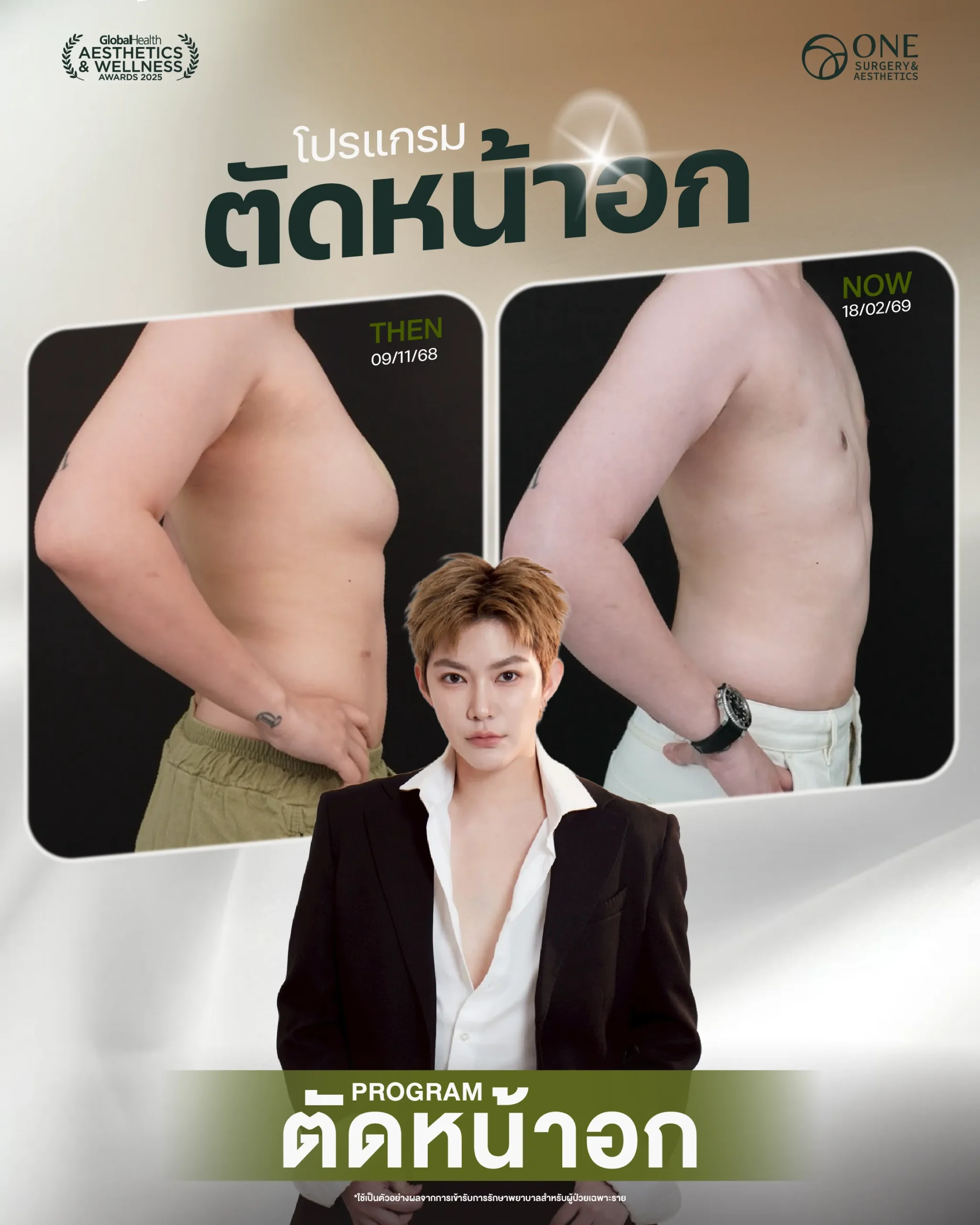 รวมรีวิว ตัดหน้าอก-01
