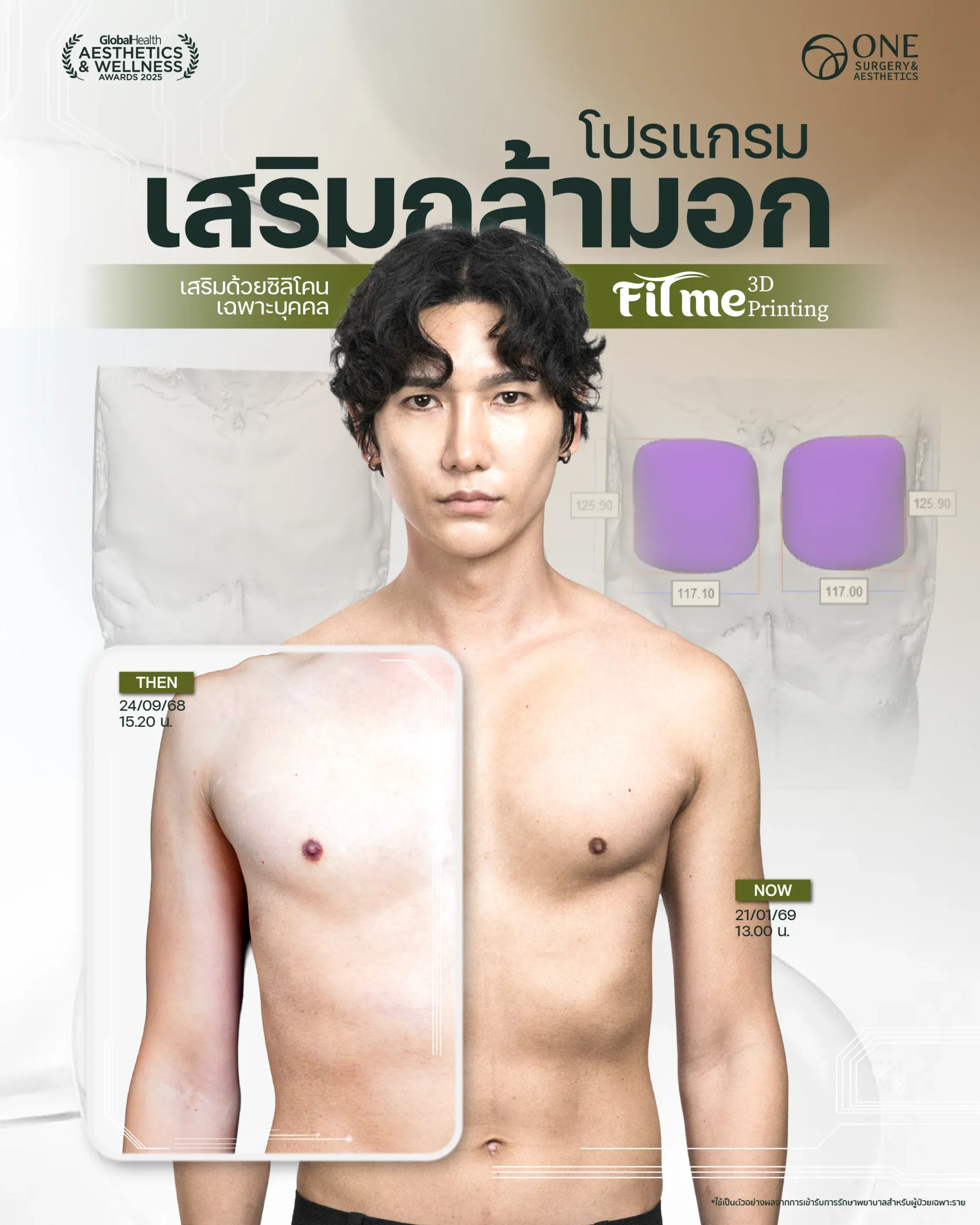 รวมรีวิว เสริมกล้ามอก Web-01