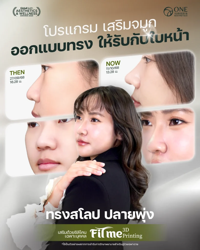 รวมรีวิว เสริมจมูก 6 ภาพใหญ่ Web_คุณพุธิตา_6