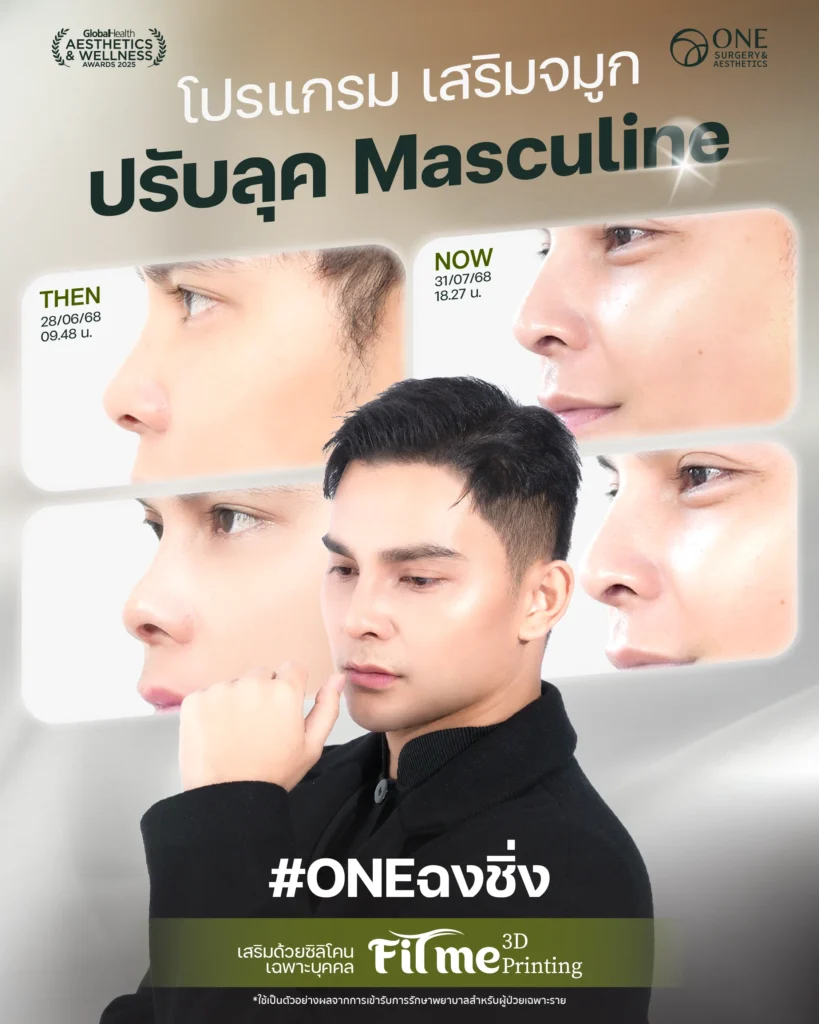 รวมรีวิว เสริมจมูก 6 ภาพใหญ่ Web_คุณเบิร์ต_7