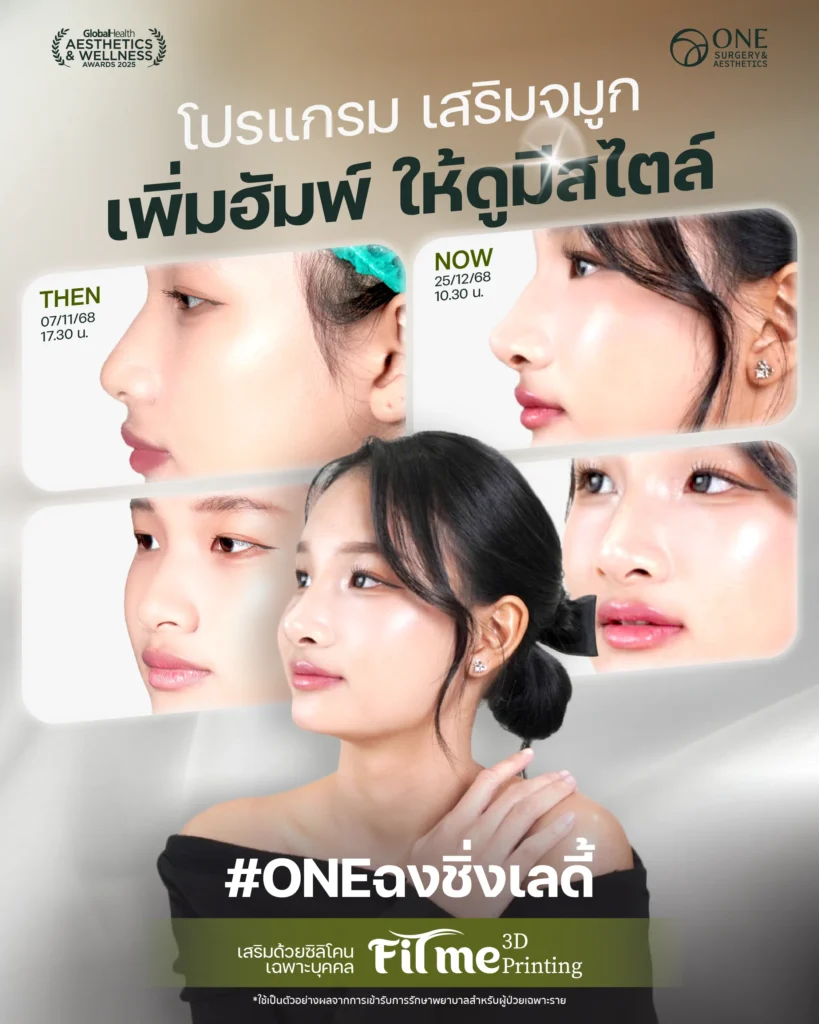 รวมรีวิว เสริมจมูก 6 ภาพใหญ่ Web_อาหมวย_2