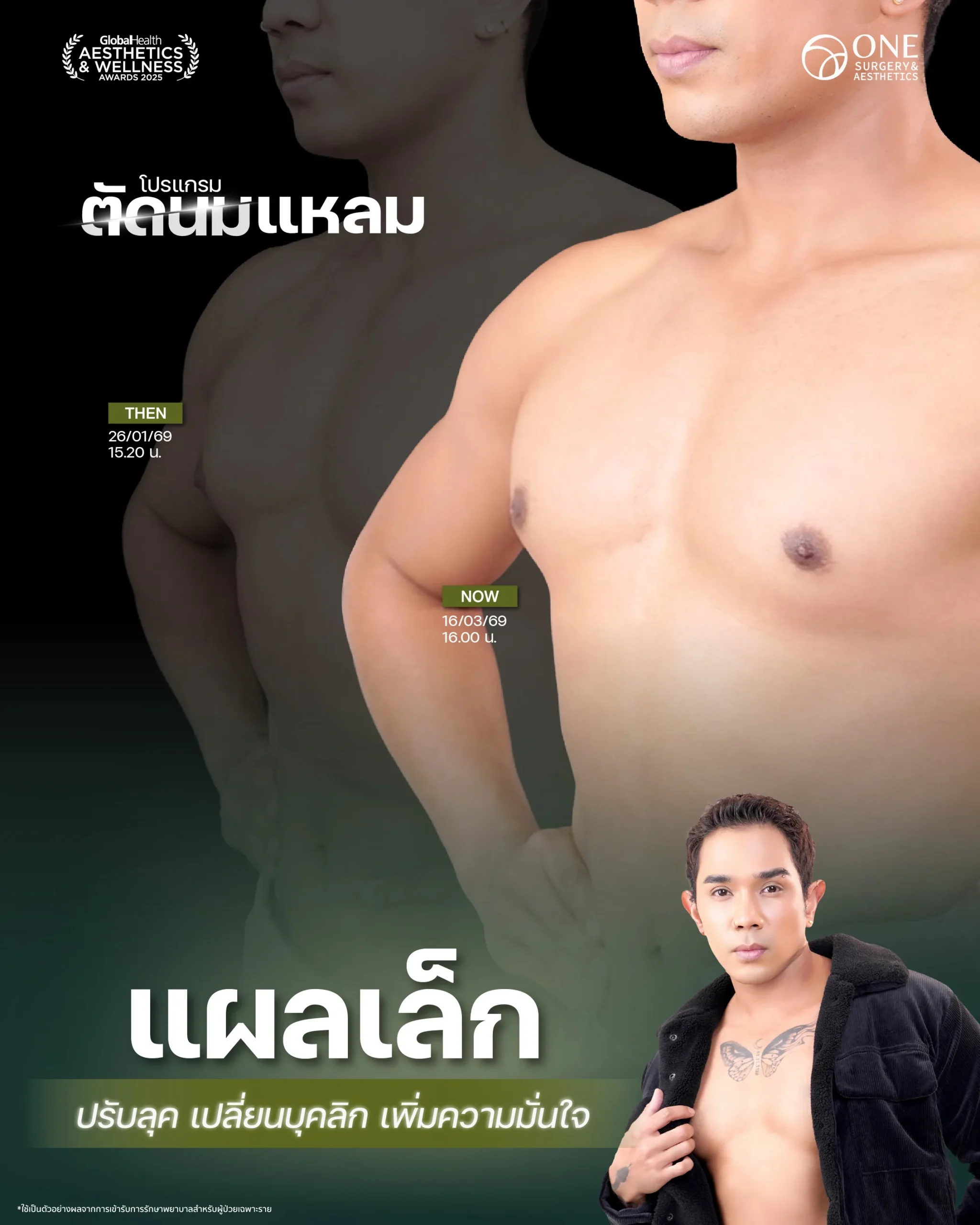 ตัดนม