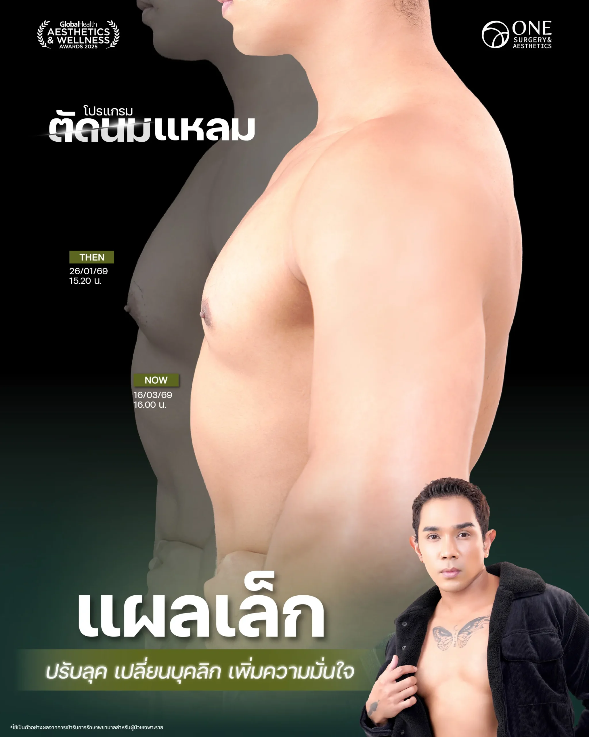 ตัดนม