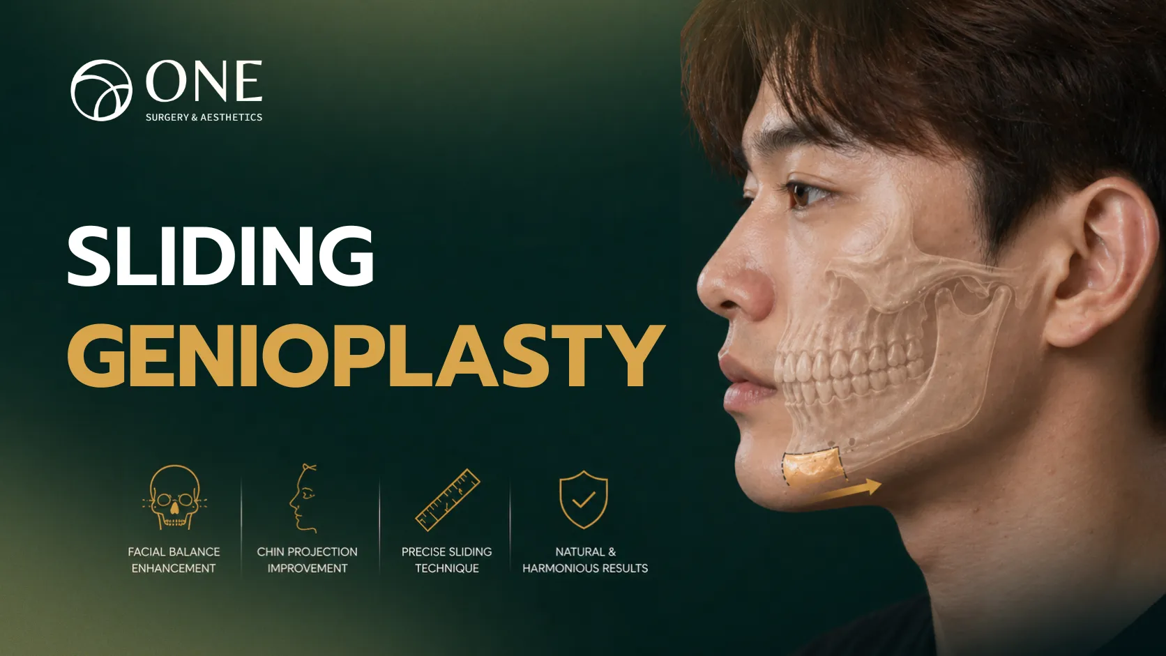 05 Genioplasty_11zon