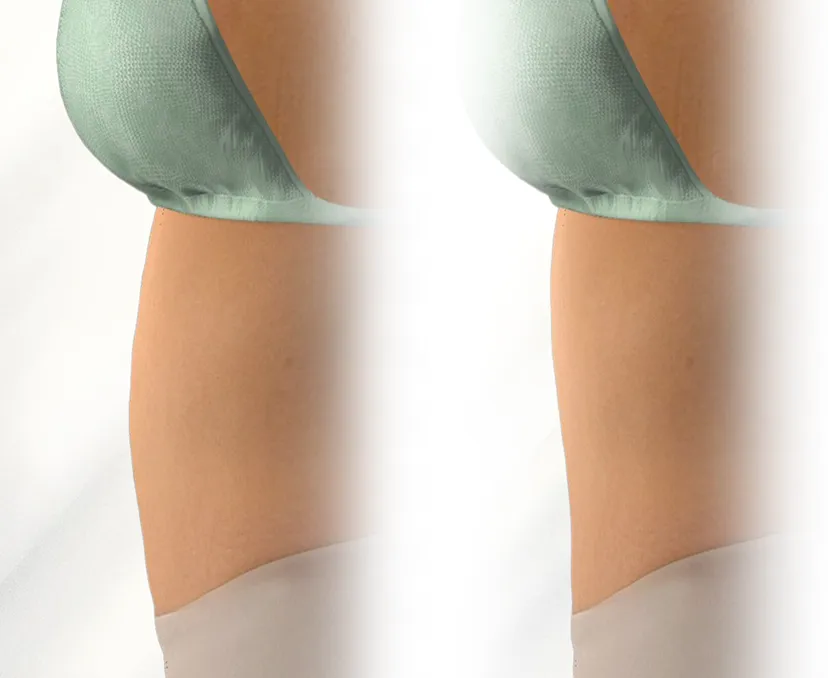 สแกนรูปร่างและออกแบบสัดส่วนด้วยระบบ 3D