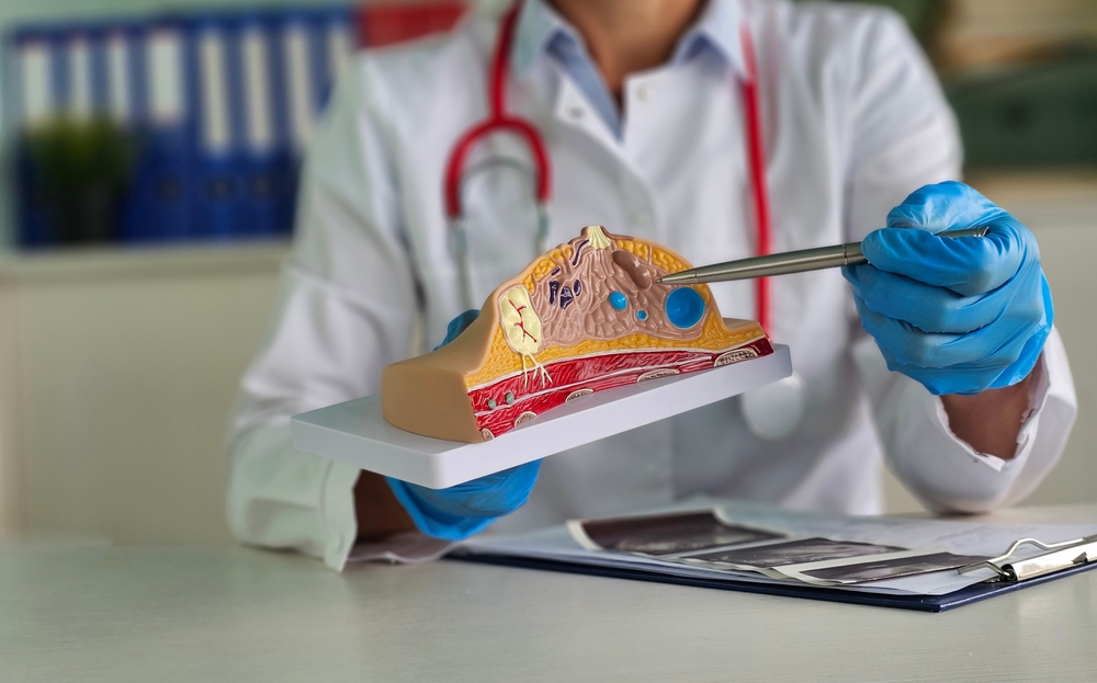 A surgeon explaining the breast anatomy before breast augmentation