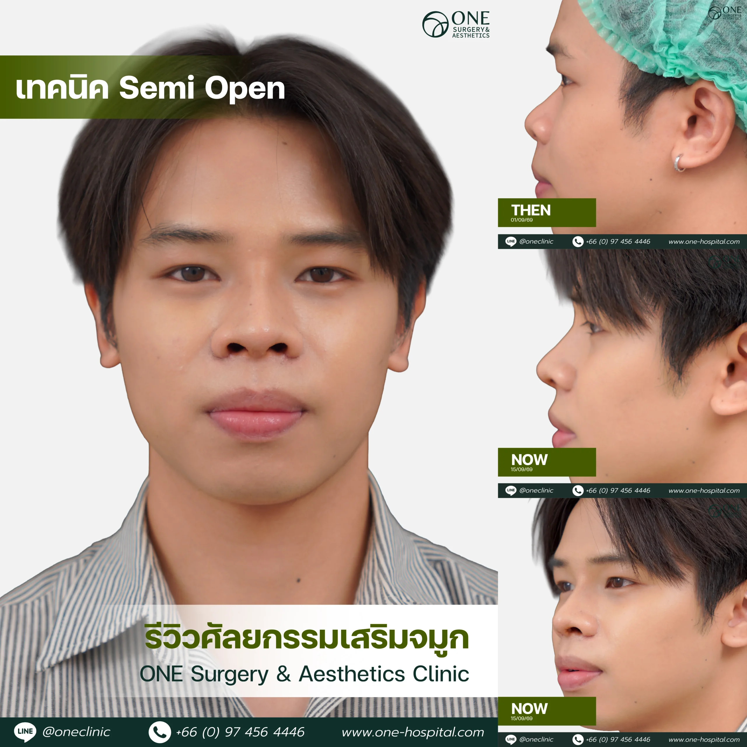 รวมอัลบัมจมูกของทุกคนที่เคยทำลง Web V.2-04