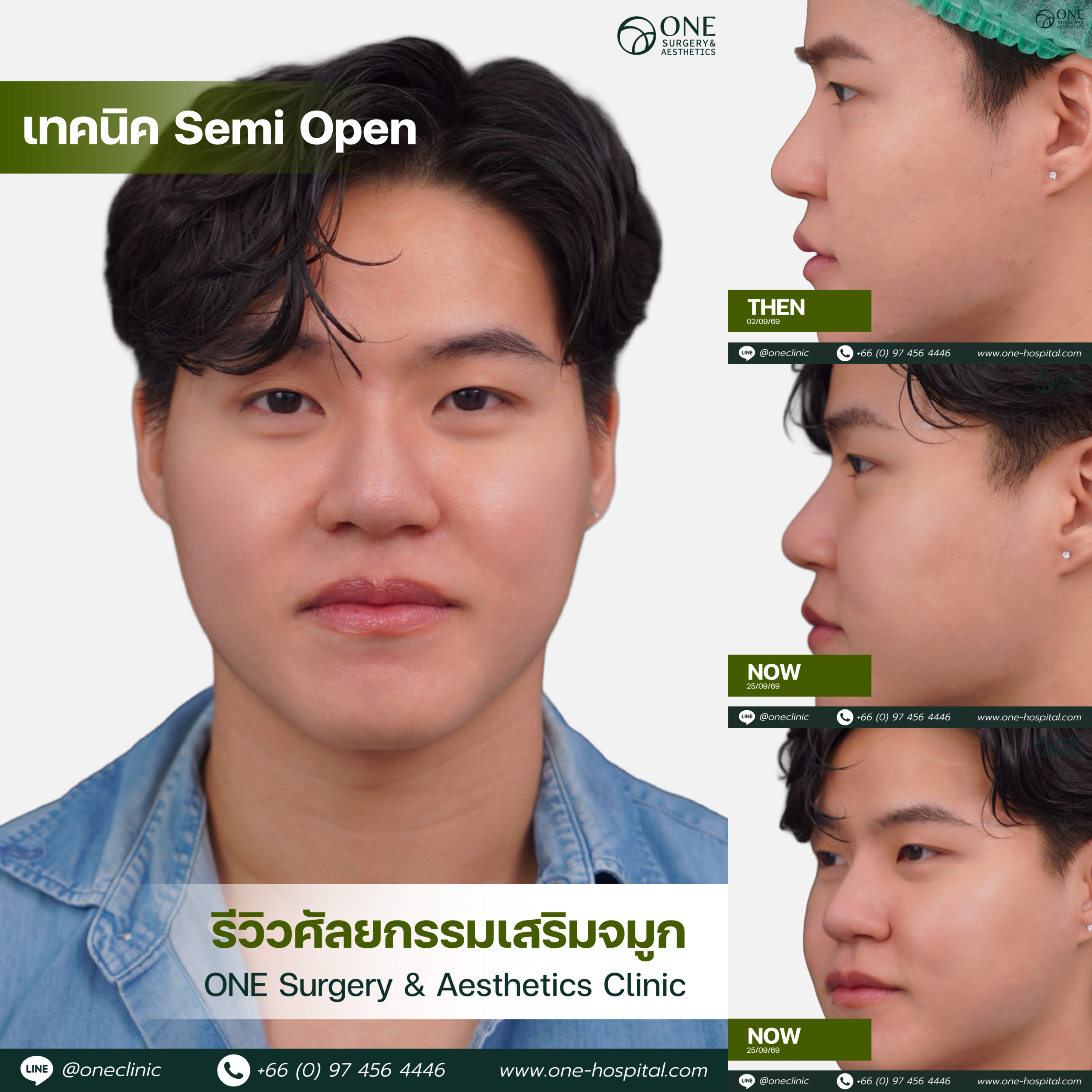 รวมอัลบัมจมูกของทุกคนที่เคยทำลง Web V.2-05