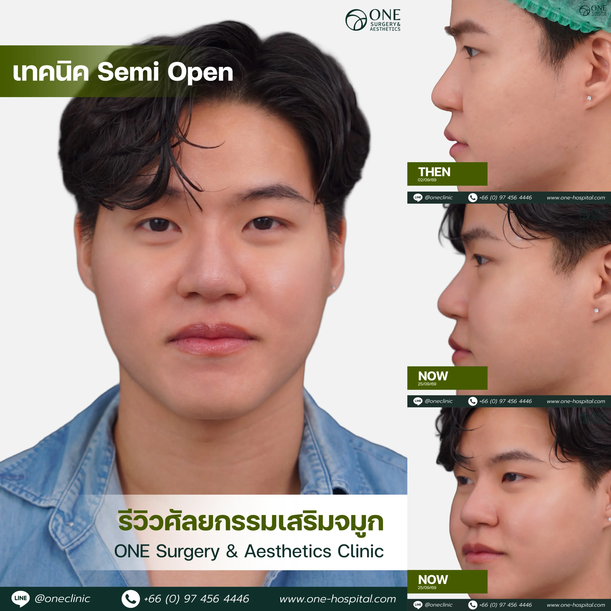 รวมอัลบัมจมูกของทุกคนที่เคยทำลง Web V.2-05