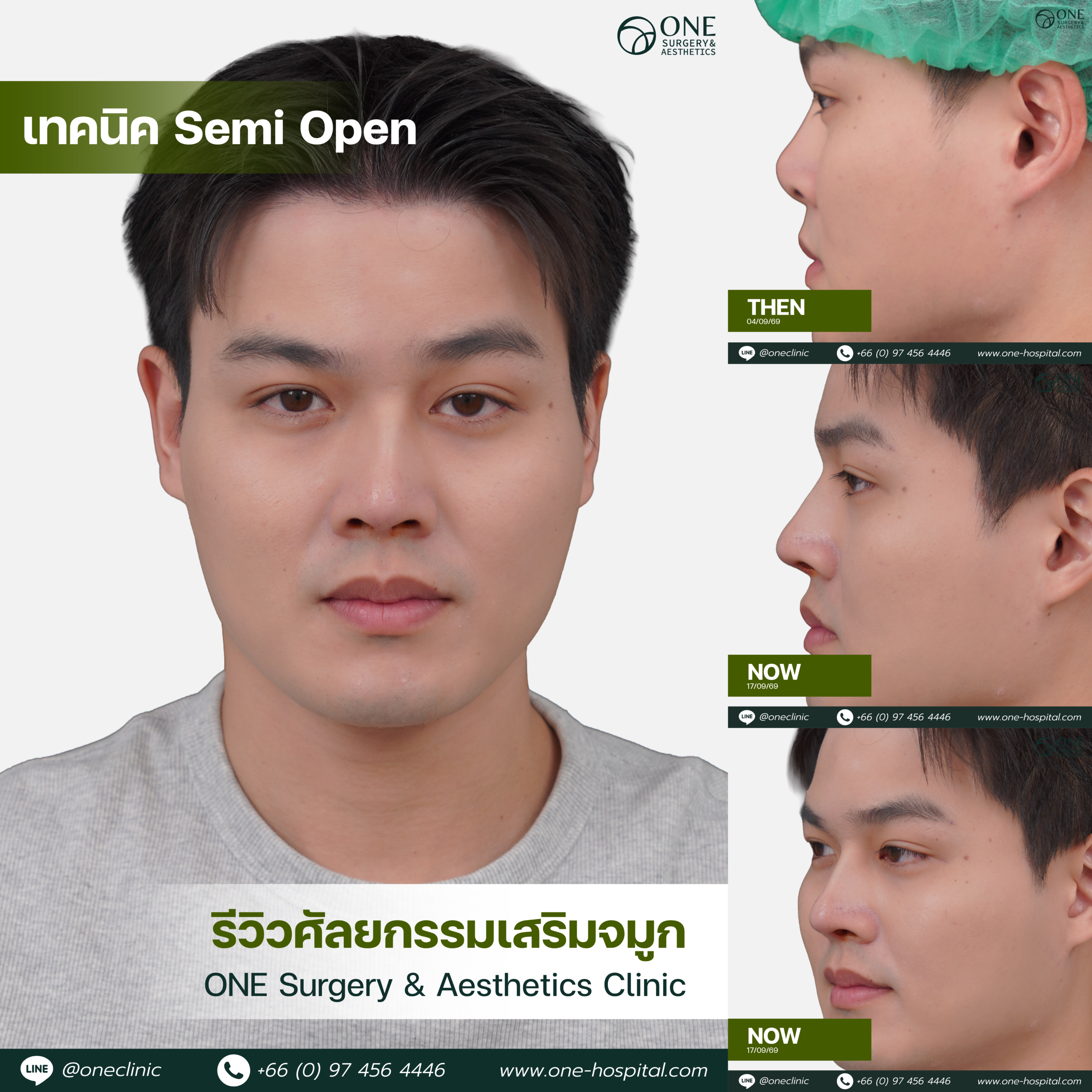 รวมอัลบัมจมูกของทุกคนที่เคยทำลง Web V.2-06