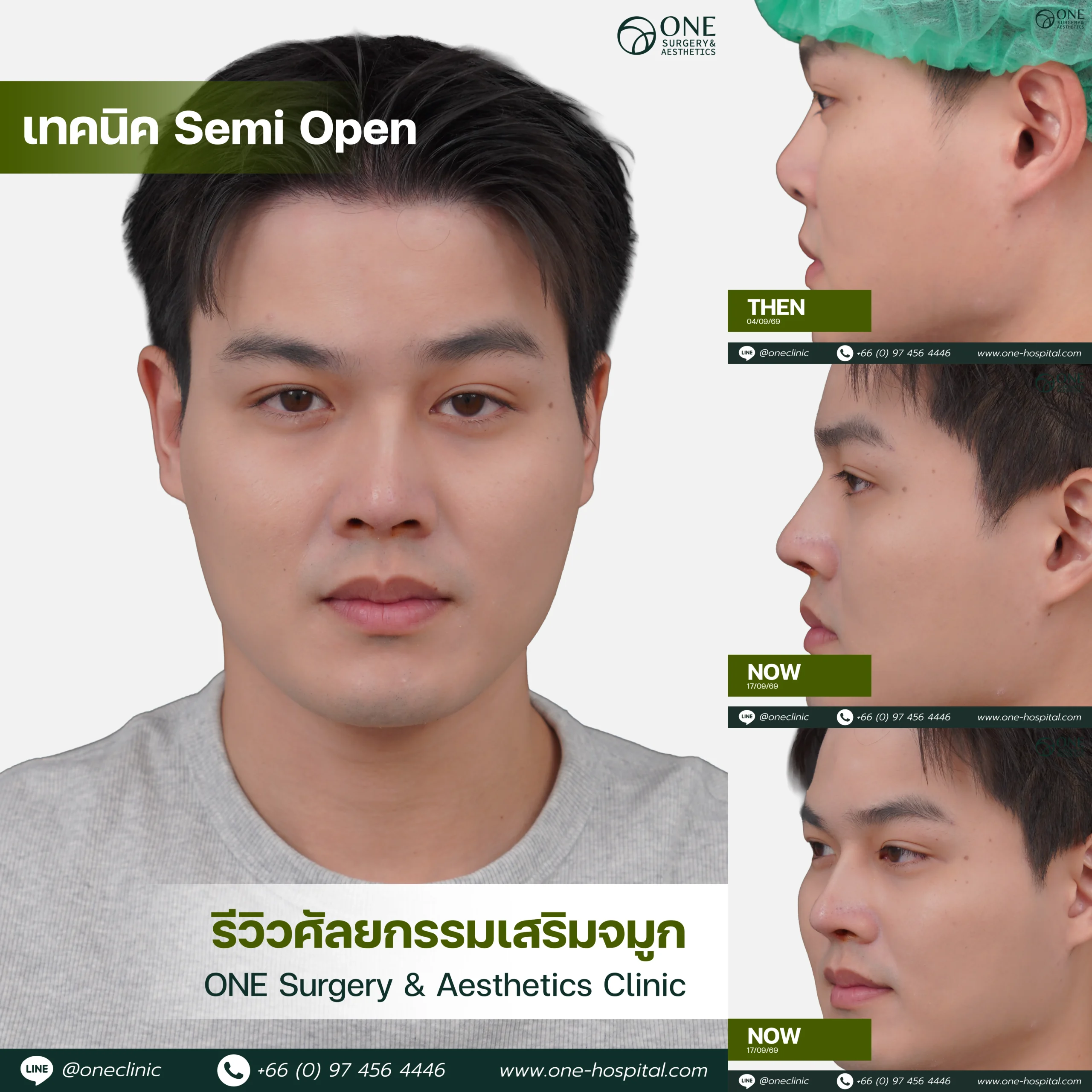 รวมอัลบัมจมูกของทุกคนที่เคยทำลง Web V.2-06