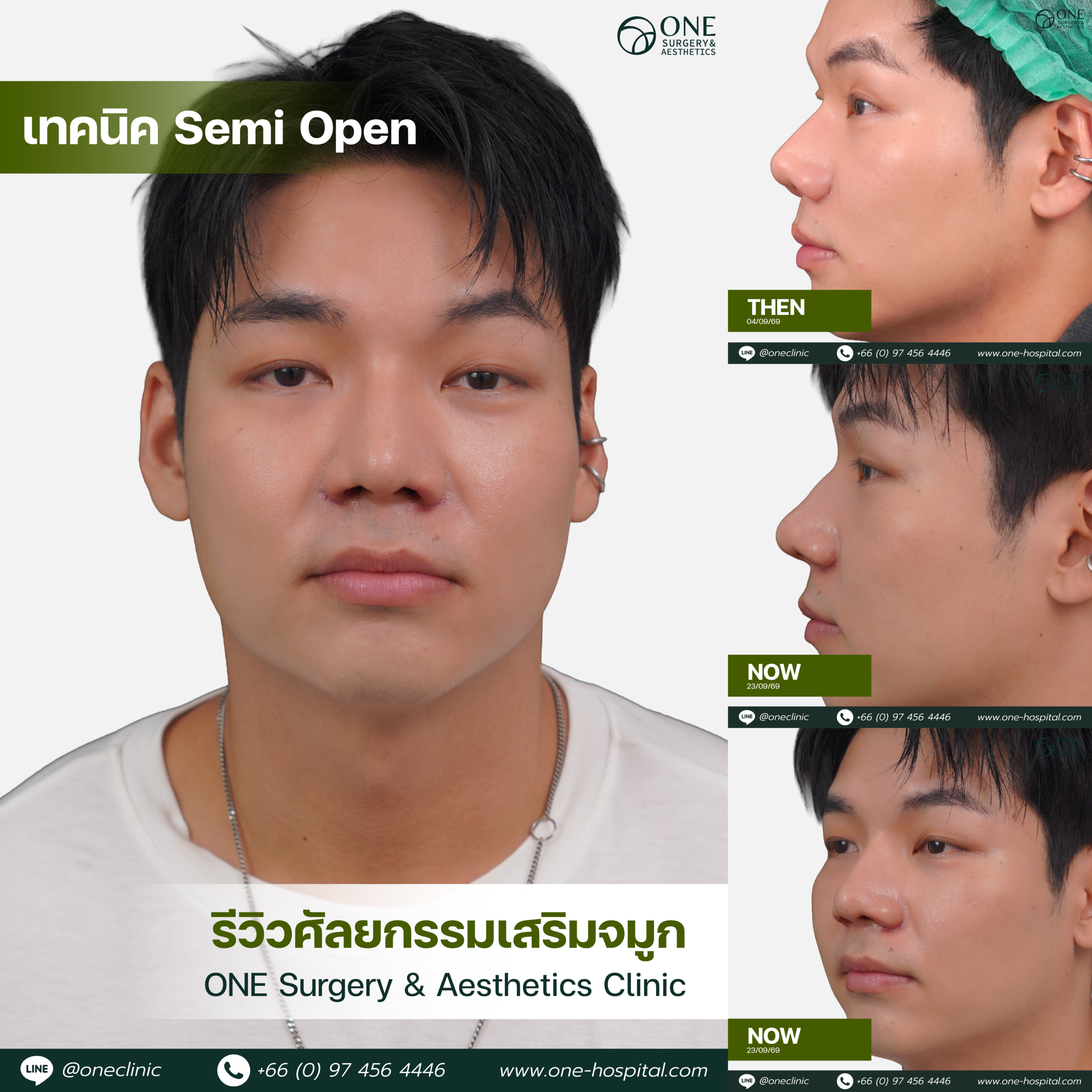 รวมอัลบัมจมูกของทุกคนที่เคยทำลง Web V.2-07