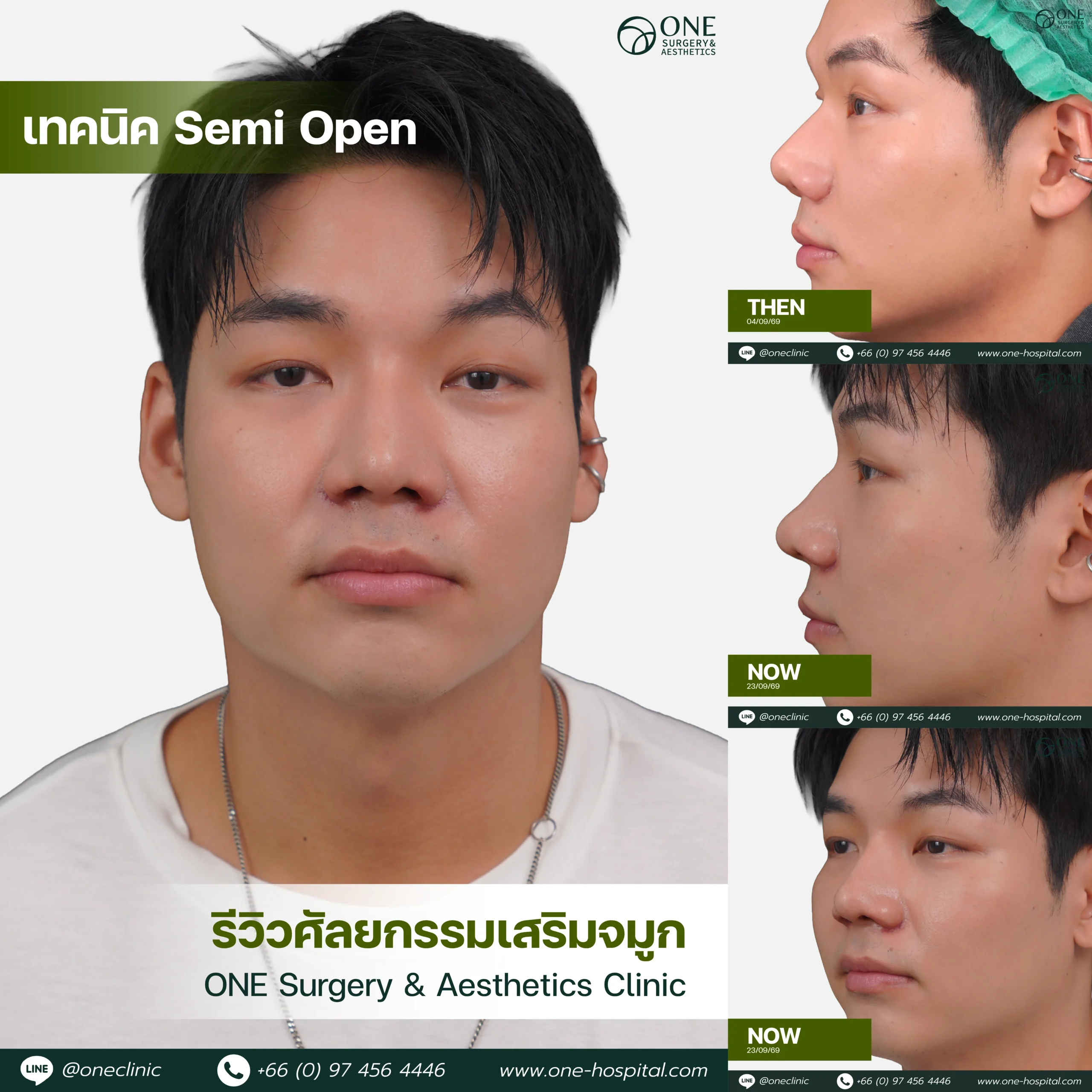 รวมอัลบัมจมูกของทุกคนที่เคยทำลง Web V.2-07