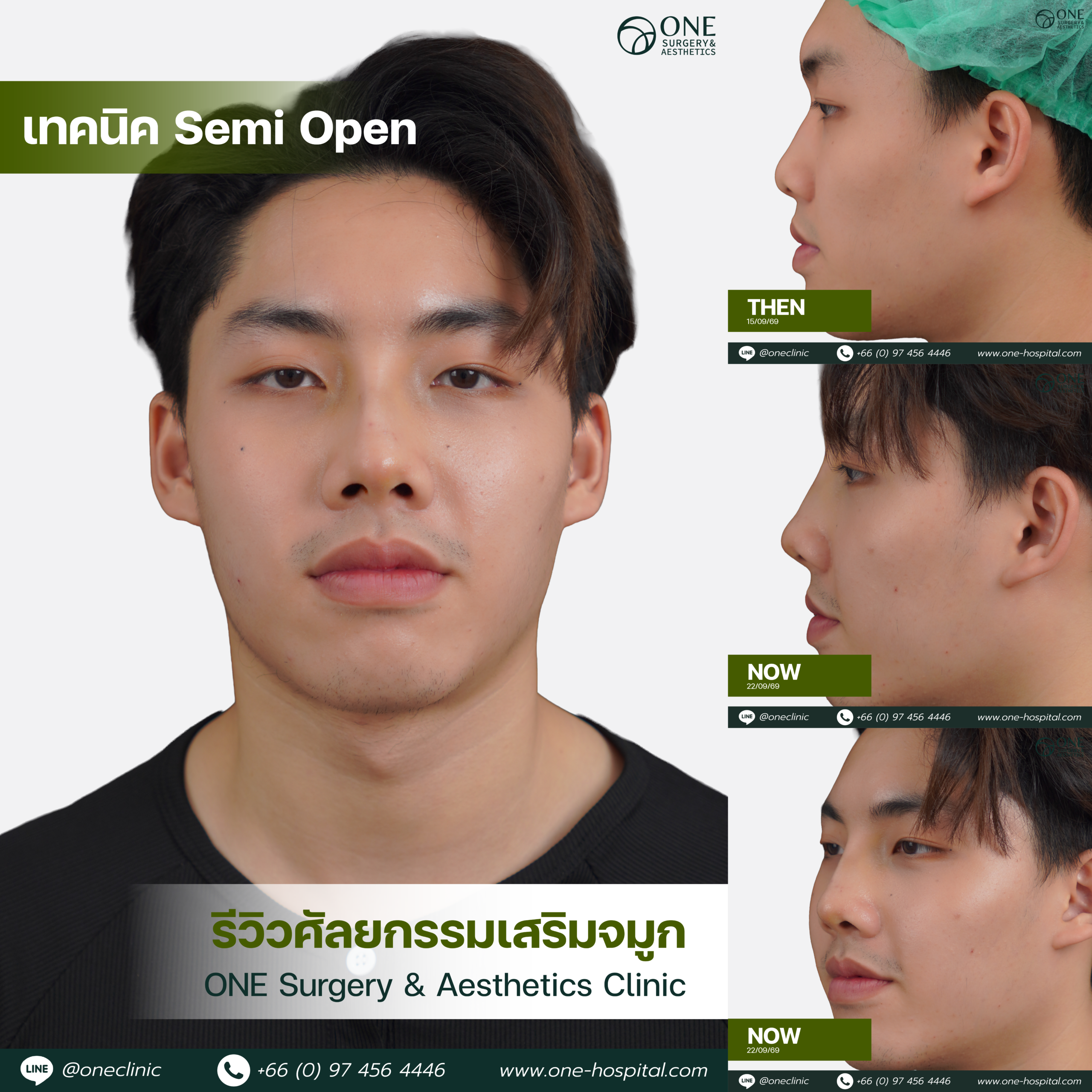 รวมอัลบัมจมูกของทุกคนที่เคยทำลง Web V.2-08