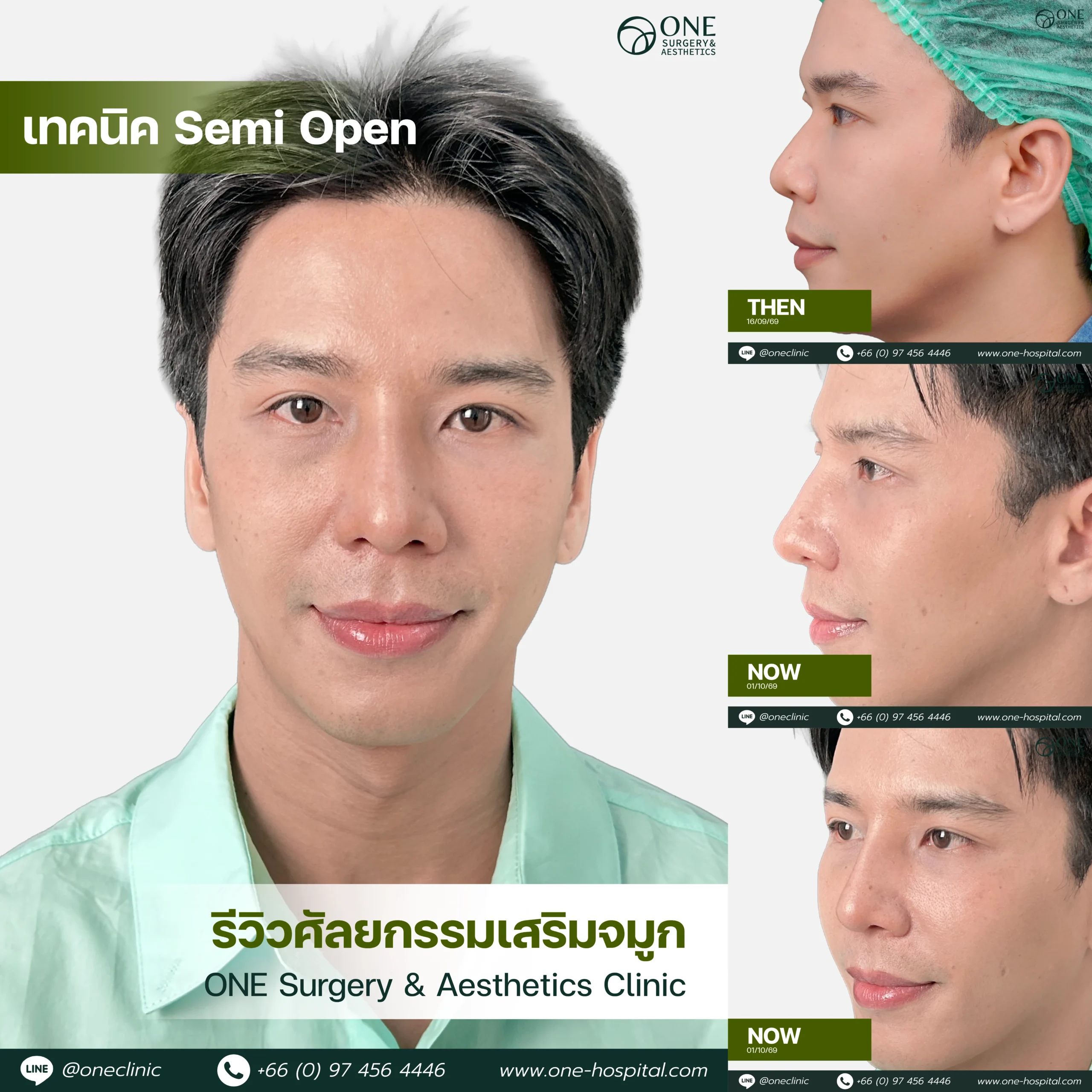 รวมอัลบัมจมูกของทุกคนที่เคยทำลง Web V.2-09